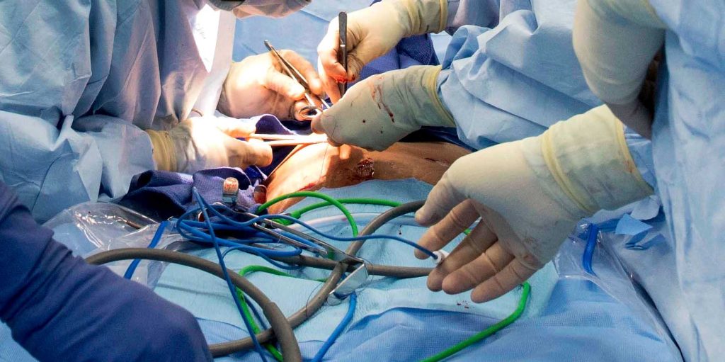 gallstones treatment surgery