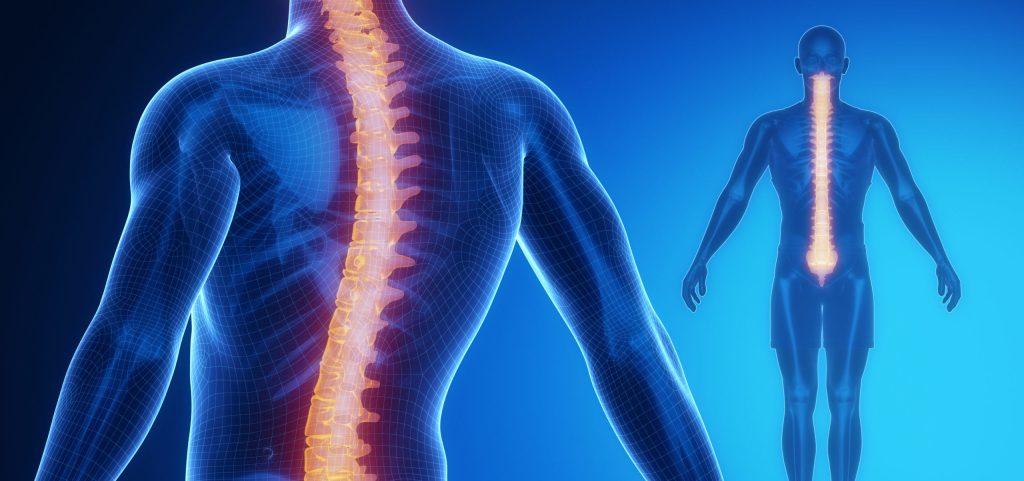 curved spine scoliosis treatment
